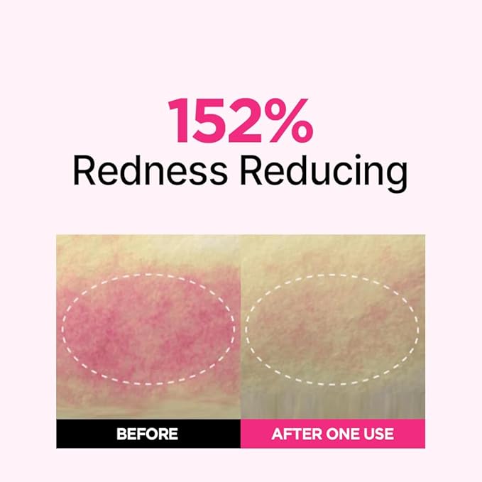 ISOI Blemish Care Up Serum Triple Set, Korean Skin Care for Glass Skin Radiance, Includes 2 Full Size & 1 Refill Serums, Eye & Wrinkle Patch Tester, Daily Hydration Gift Set (2.13 fl. oz)