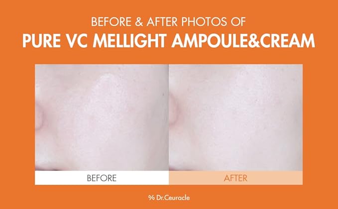 Dr.Ceuracle by leegeehaam Pure VC Mellight Ampoule - Vitamin C Serum for Face, One Week Program for Anti-oxidant, Firm, Clarify, Fade Pigmentation, Skin Radiance (4 Counts (Pack of 1))