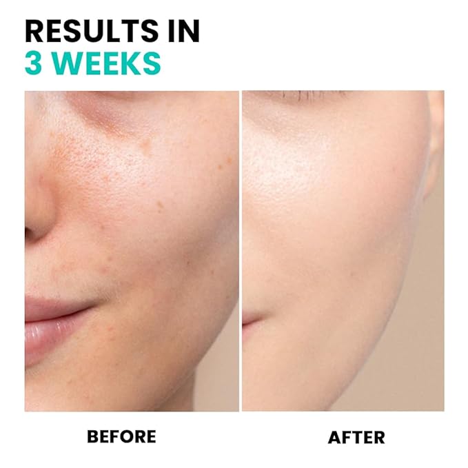 Conatural Brightening Serum 30ml - Radiant Face Serum, Daily Hydration, Antioxidant-Infused for Luminous Complexion, Water-Based Facial Serum for Radiance