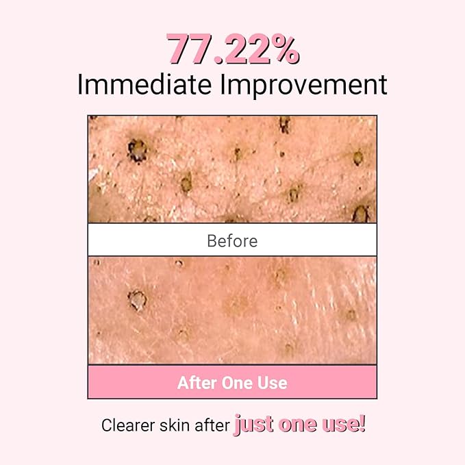 Kaolin Purifying Wash Off Pack, Pore Cleansing Mask for Dry Sensitive Skin, Softening amd Hydrating, Korean Skincare (3.88oz / 110g)