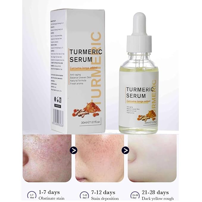Lumibalm for urmeric Dark Spot Serum Oil, Turmeric Face Serum Oil, Bright Skin Dark Spot Corrector Face,Turmeric Facial Serum,Turmeric Face Serum Oil,Turmeric Face Oil Moisturizing.