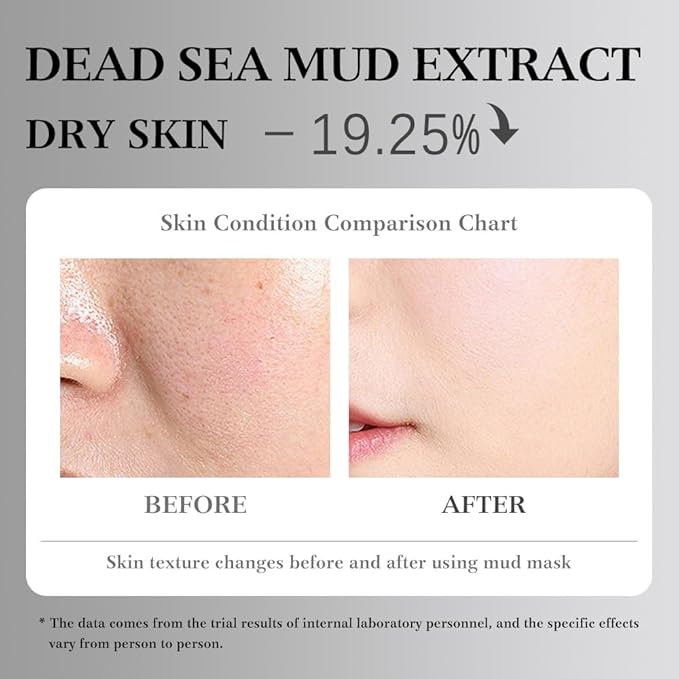 10X Collagen Anti-Aging Sleep Mask โ Active Protein Technology โ Intensive Hydration, Reduces Sagging & Dullness, Skin Care, Smooth & Whitilight, Cruelty-free (10PCS-Mud Mask-Dead sea mud White)