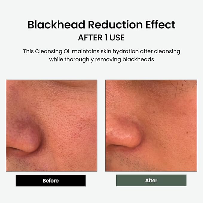 Liposome Daily Cleansing Oil, Gentle Makeup & Blackhead Remover for Sensitive Skin with Centella Asiatica TECA, Korean Skincare for Trouble Care (6.76 fl. oz., 200ml)