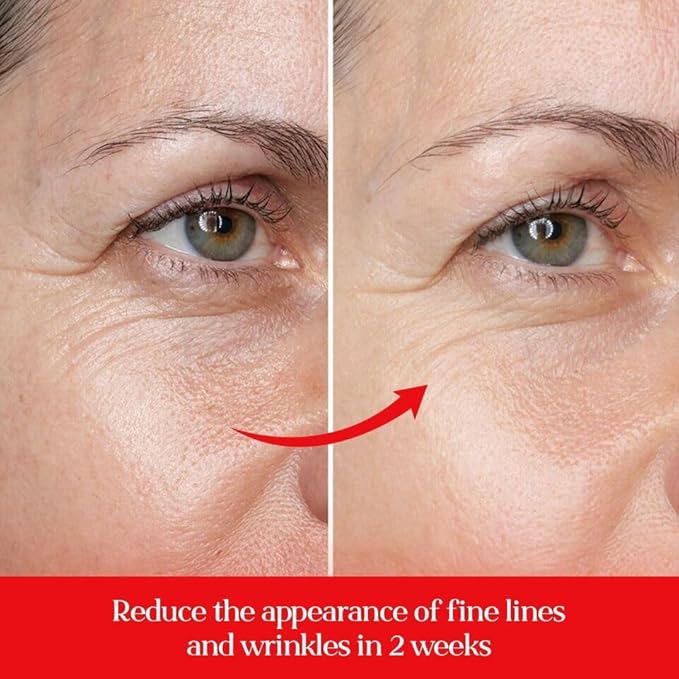 5% Caffeine Eye Cream Anti Aging with 360 Rollerball, Reduce Wrinkles and Dark Circles, Under Eye Cream For Women and Men