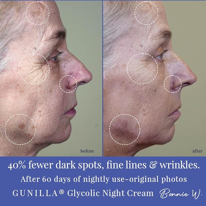 GUNILLA Glycolic Acid Night Cream - Refine, Resurface & Reduce Fine Lines, Wrinkles, Dark Spots, Congested Pores While Brightening Complexion. Gentle - Natural - Vegan (2 oz)