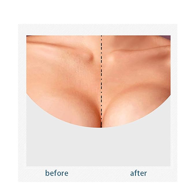 VolksRose Face & Chest Wrinkle Patches, Reusable Silicone Patches for Brow Lift, Wrinkle Smoothers, Cleavage - Overnight Anti-wrinkle Face Tape Mask, Smoothing Pads for Anti-wrinkles