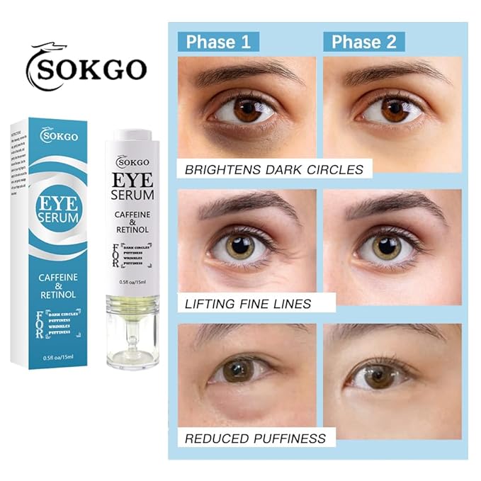 Caffeine Eye Serum, Retinol Eye Firming Serum for Dark Circles and Puffiness, Anti Aging Eye Serum with Hyaluronic Vitamin E, Smooth Fine Lines and Hydrate Eye Area