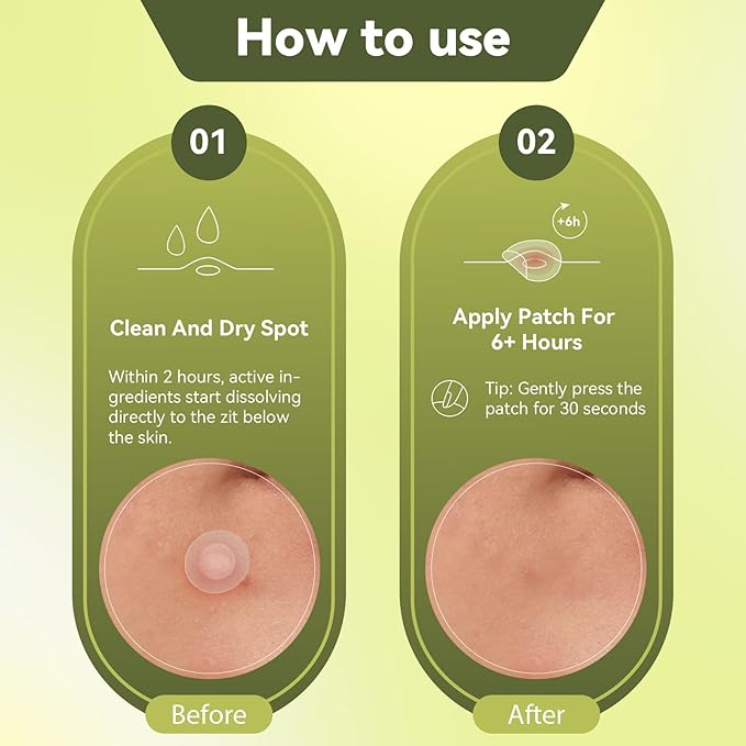 Micro Hydrocolloid Patch 24 Counts, Day & Night Clear Treatment Spot Remover Pimple Stickers, Spot Dots for Face Zit Patches