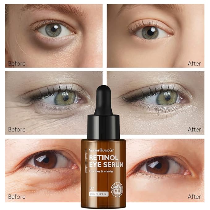 Retinol Eye Serum, Anti-Aging with Hyaluronic Acid Vitamin E Ceramide for Dark Circle, Fine Lines & Under Eye Bags Visibly Reduces, 1.02 fl.oz