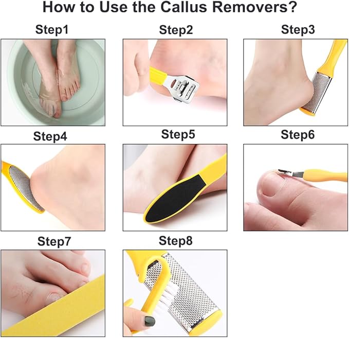 Stainless Callus Removers Set Foot File Pedicure Tools Kit for Feet Nail Clippers Set Fingernail Clipper Toenail Clipper Nail Care Tool with Travel Case for Men Women