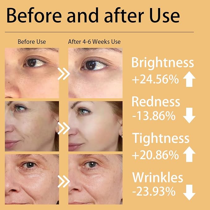 K11 LED Red Light Therapy Face Mask & Neck | 7-Color Light Modes + Near-Infrared | 5 Timers & 3-Speed Settings| Portable Foldable Design for Home & Travel Skincare