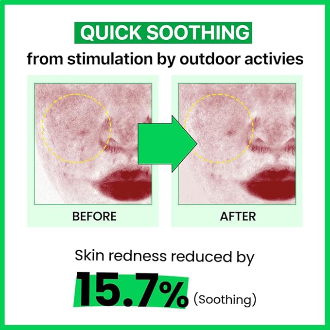 Real Barrier Cica Relief Rx Fade In Serum 50ml 1.69 fl. Oz. |Calming & Skin Recovery Face Serum, Instant Relief from Skin Irritation, Moisturizing & Soothing Serum for Sensitive Skin, Korean Skincare