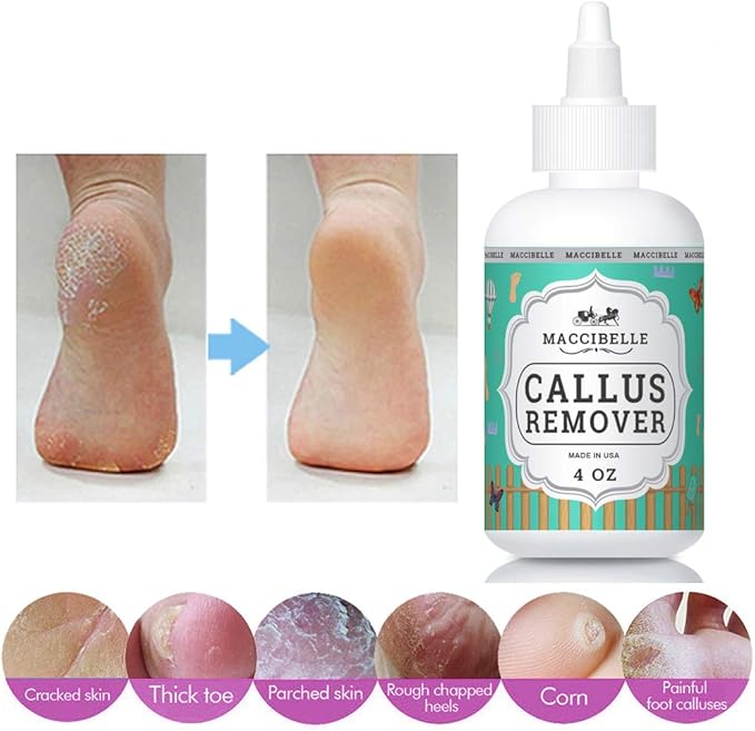 Maccibelle Callus Remover EXTRA STRENGTH For Feet, Professional Callus and Corn Eliminator Liquid Gel 4 oz (1 Bottle)