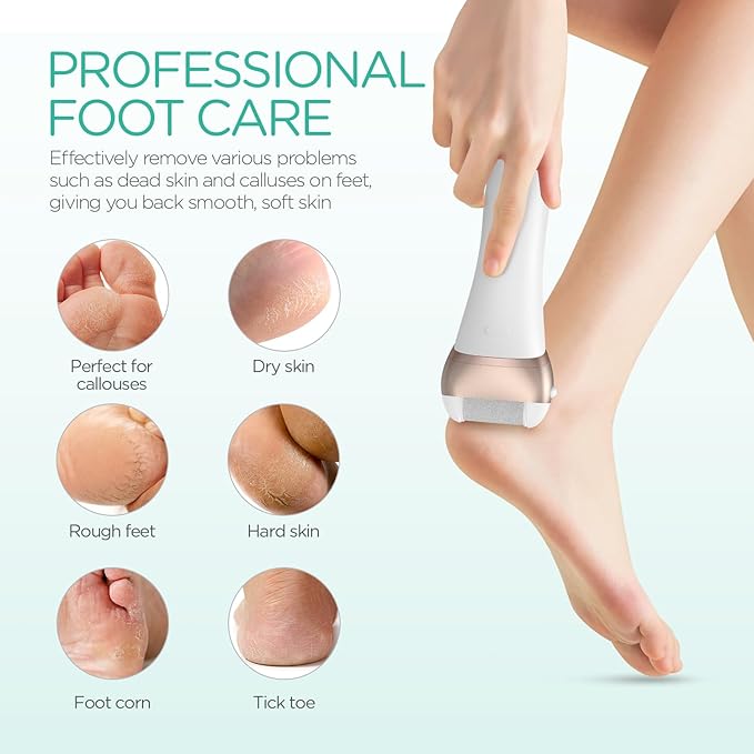 VOYOR Electric Foot Callus Remover Rechargeable Foot File Waterproof Pedicure Tools, Professional Callus Remover for Feet 3 Roller Heads Foot Scrubber Electric Foot Grinder CR300 (Champagne Gold)