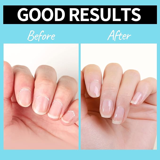 Teenitor Cuticle Care kit with Cuticle Remover and Cuticle Oil