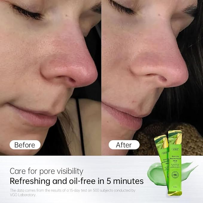 VGO Blackhead Remover Bubble Clay Mask, Deep Moisturizing & Pore Cleanser Face, with Salicylic Acid & Hyaluronic Acid,Daily Hydrating Facial Care & Skin Blackhead Mud, 12pcs (1.08 Ounce (Pack of 1))