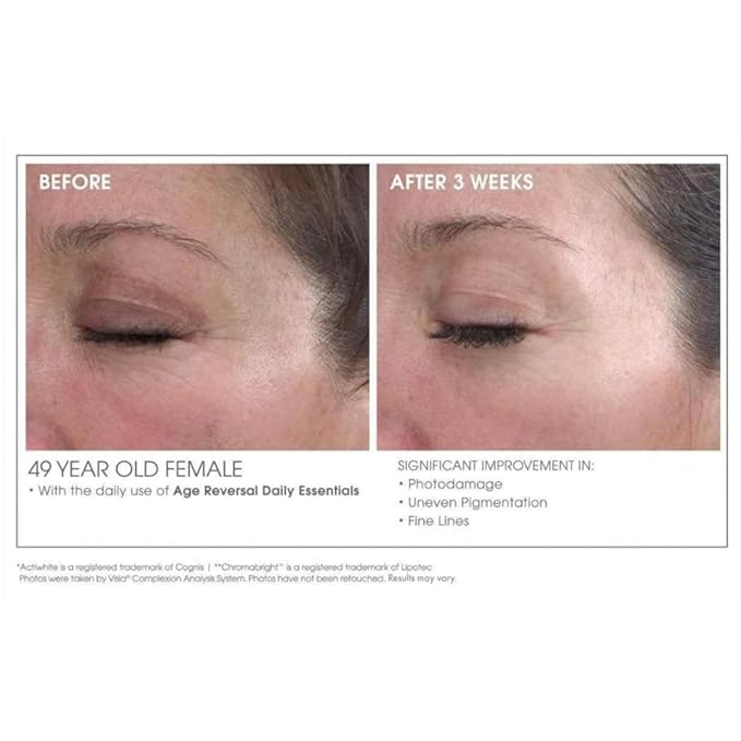 Glowbiotics Advanced Retinol Renewal Treatment: Nightly Anti-Aging Cream for Smoother, Brighter Skin | Firms & Reduces Pores with Retinol