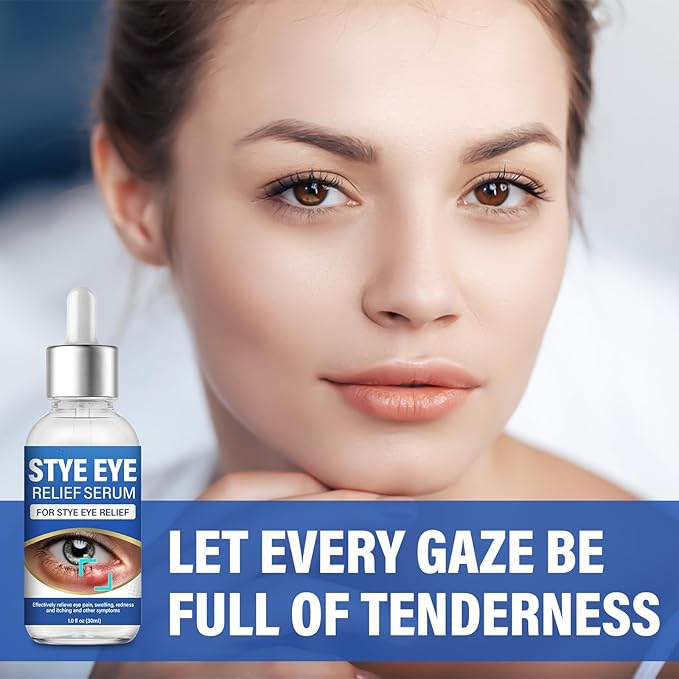 ITECFREELY Stye Eye Treatment, Natural Stye Eye Relief Drops Serum for Styes Chalazion and Blepharitis, Fast Chalazion Remover for Restore Healthier Skin-1 Fl.oz