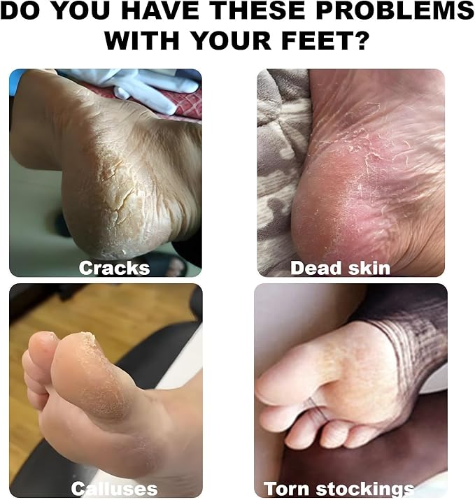 Electric Feet Callus Remover,Foot File Grinder Tool with Speed Controller and 60pcs Replacement Sandpaper Disk,Pedicure Tools for feet for Men Women Dead Dry Crack Skin Calluses