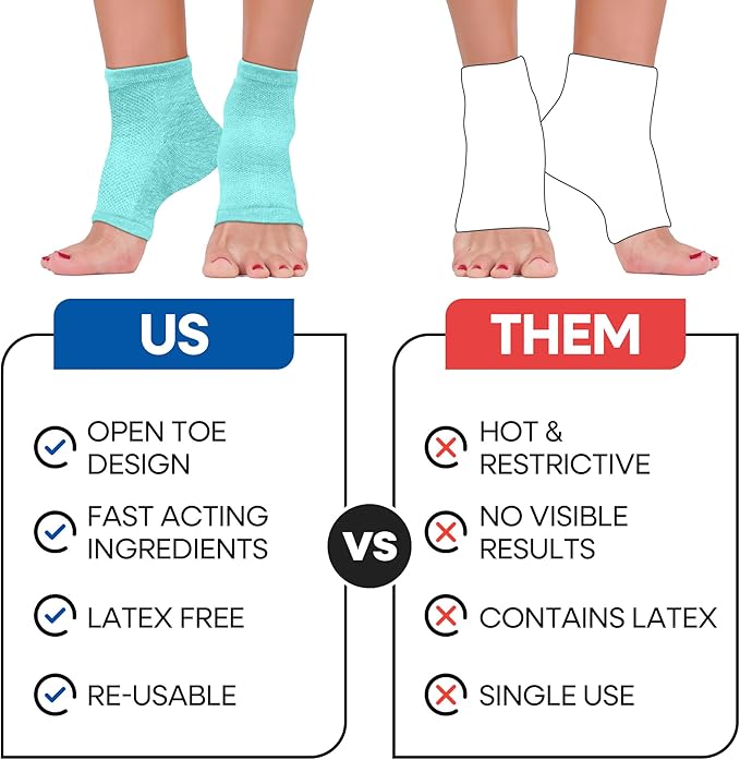 Moisturizing Socks for Women & Men | Aloe Vera Cracked Heel Treatment | Foot Callus Remover | Aloe Socks for Cracked Heels & Dry Cracked Feet | Lotion Infused Gel Heel Socks (Fits Most - 2 Pairs)