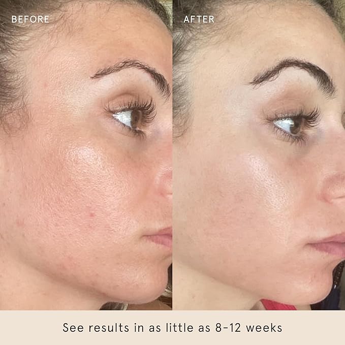 Barefaced Liquid Gold 30ml - 15% Vitamin C Serum with Hyaluronic Acid & Vitamin E for Anti-Aging, and Hydration, Antioxidant Formula, Reduces Dark Spots, Acne & Wrinkles