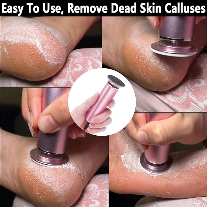Electric Foot File Callus Remover for Feet, Adjustable Speed Foot Sander Grinder Professional Pedicure Tools for Dead Skin Heel Calluses with Replaceable Sandpaper Discs (Upgraded FCR-1 Pink)