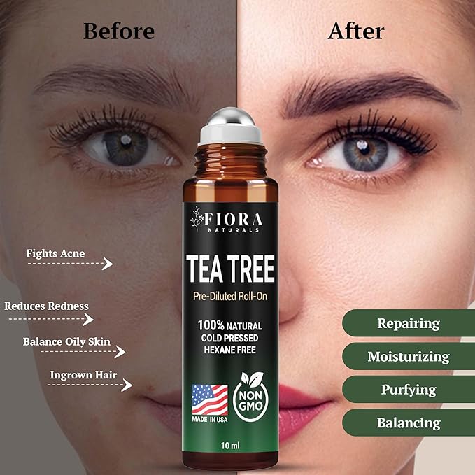 Fiora Naturals Tea Tree Oil Roll On - 100% Natural Tea Tree Essential Oil for Skin, Face, Acne, Nails, Cuticles, Scalp & Aromatherapy Wellness
