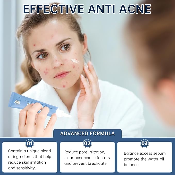 14% Azelaic Acid Acne Cream, 2PCS Azelaic Acid Serum with Hyaluronic Acid, Niacinamide & Squalane, Reduce Acne, Pore Refining & Oil Control, Face Moisturizer for All Skin Types