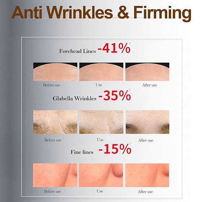 Bo-tox Bee Venom Cream for Lifting & Firming Saggy Face/Neck/Eyes, Wrinkle & Fine Lines & Eye Bag Removal, Restoring Elasticity & Deeply Moisturizing, Natural Bee Venom Serum for All Skin Types, 20 G