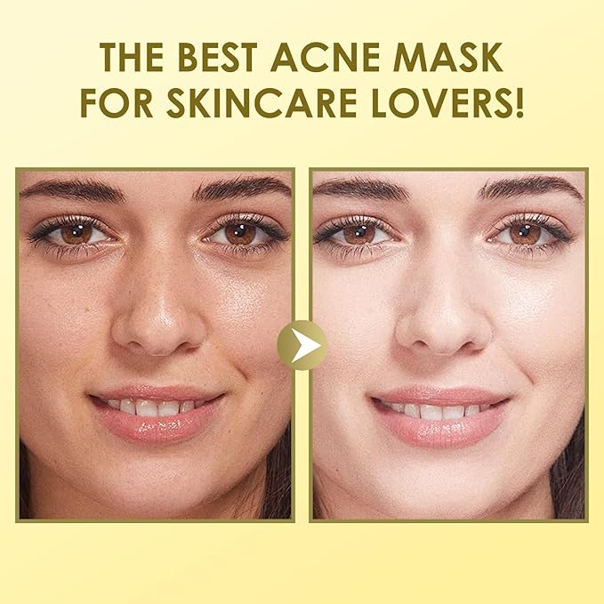 Face Masks Skincare, Snail Mucin Sheet Mask 10 Pack With Snail Mucin Serum, Hydrating Face Mask For Dry, Sensitive Skin, Self Care, Sheet Masks, Facial Masks For Women Skin Care, Bridesmaid Gifts