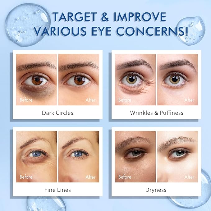 Advanced Eye Serum with Caffeine & Retinol,Eye Treatment Cream for Dark Circles Under,Anti Aging Eye Serum with 360°Massage Roller for Eye Massage Ball-0.5 fl.oz