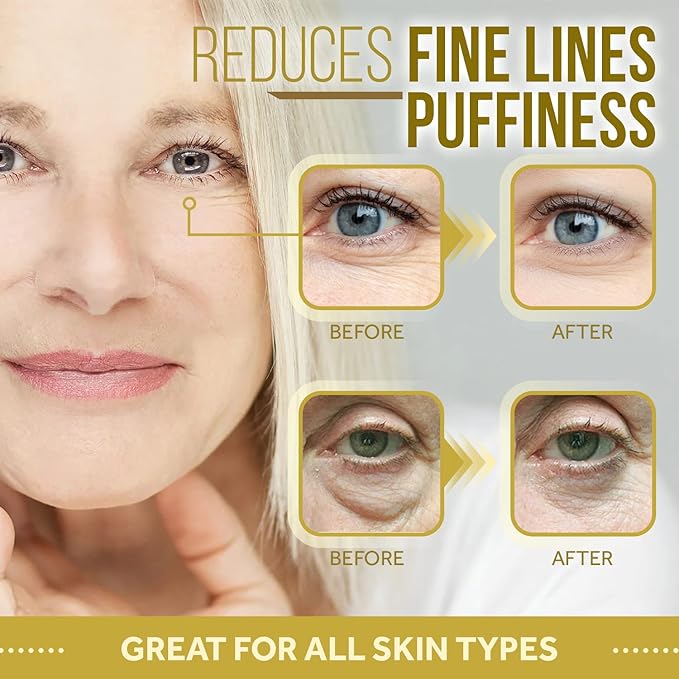 Forehead and Under Eye Wrinkle Patches for Face - Collagen, Hyaluronic Acid and Vitamin A Skin Pads - Forehead Line Remover Wrinkle Eye Patch Set - 26 Strawberry Sachets