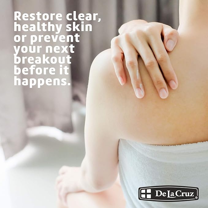 De La Cruz 5% Sulfur Ointment Travel Size - Cystic Acne Treatment for Face and Body - Daily 10 Min Spot Treatment and Effective Game Changing Hormonal Acne Treatment that Clears Up Pimples 0.21OZ