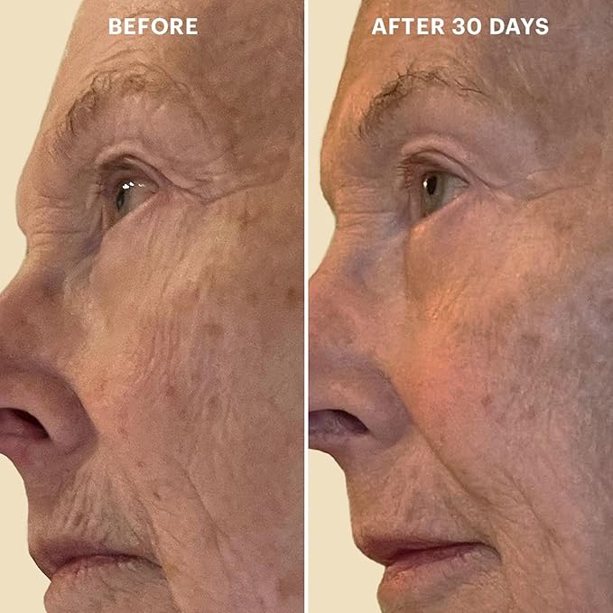 Glo Skin Beauty Bio-Renew EGF Eye Cream - Epidermal Growth Factor Cell Repairing Eye Cream, Combats Signs of Aging By Repairing, Hydrating & Firming Skin