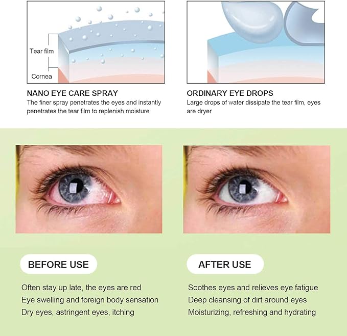 Dioche Portable Dry Eye Humidifier & Facial Steamer - Eye Mist Sprayer for Moisturizing, Fast Steam, Makeup (Blue)