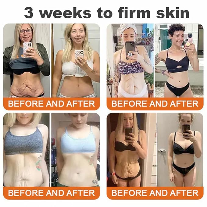 Botox Bee Venom Firming Serum Stick, Advanced Firming & Wrinkle-Reducing Cream, Bee Venom Wrinkle Remover Cream, Bee Venom Firming Serum Stick, Hydrates & Nourishes Skin (1PC)