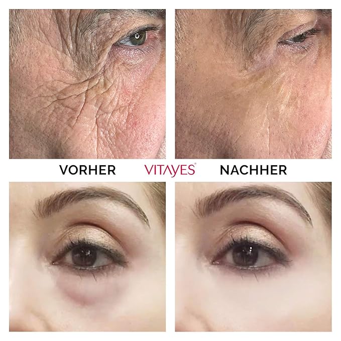 VITAYES Instant Ageback Lifting Cream, Dark Circle Bags Under Eye Remover, Anti Wrinkle and Fine Lines Face Lift Cream 0.24 Oz