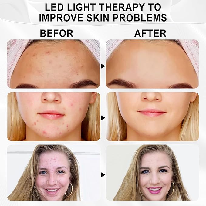 LORICK Red Light Therapy M-ask 7 Colors Touch-Sensitive Facial Red Light Mask Red Light Therapy for Face for Home Use