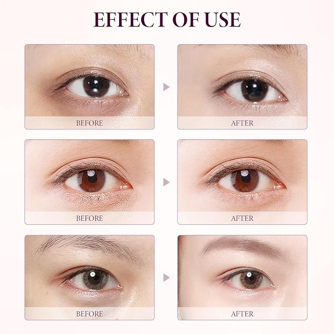 2PCS Mango Eye Cream, Eye Moisturizing Serum, Anti-Aging Treatment for Puffiness, Dark Circles & Fine Lines, Fast-Absorbing Hydration, 0.53 Fl Oz x 2