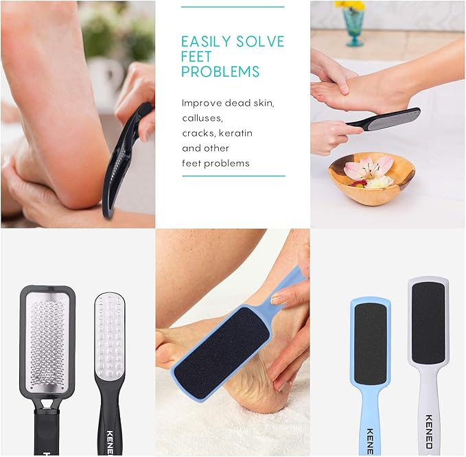 Foot Scrubber Pedicure Tools Rasp - 5 PCS KENED Foot File Callus Remover for Feet to Remove Hard Skin - 2 X Stainless Steel Black, 3 X Plastic Blue