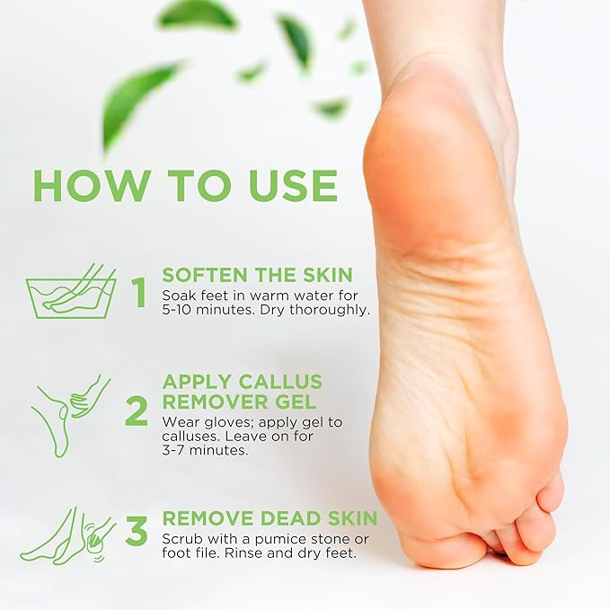 Callus Remover Gel – Professional Foot Callus Removal for Smooth Feet & Cracked Heels – Extra Strength Callus Gel with Pumice Stone – 8oz, Made in USA