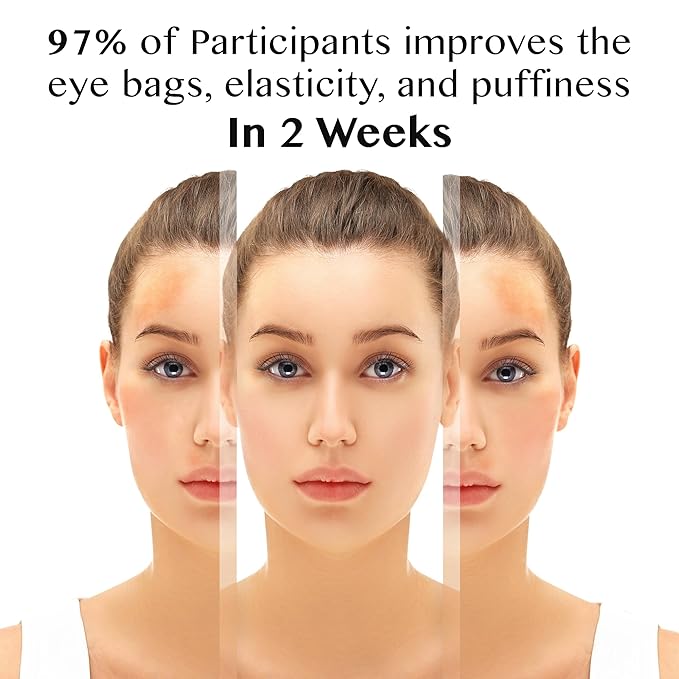 Eye Cream Roller, Collagen & Peptides for Total Eye Lift, Rapid Wrinkle Repair, Dark Circle & Under Eye Bag Treatment, Anti-Aging & Hydrating Formula, 1.01 Fl Oz. Made In Korea....