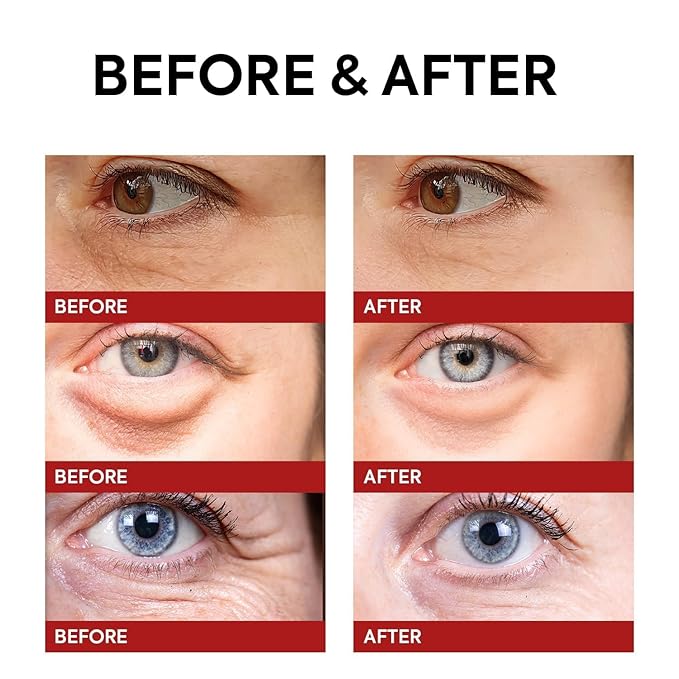 Instant Eye & Face Lift Cream: Rapid Under Eye Bags Wrinkle Smile Lines Forehead Lines Remover - Temporary Firming & Tightening Treatment in 2 Minutes - Retinol Eye Cream Anti Aging Anti Wrinkles 15g