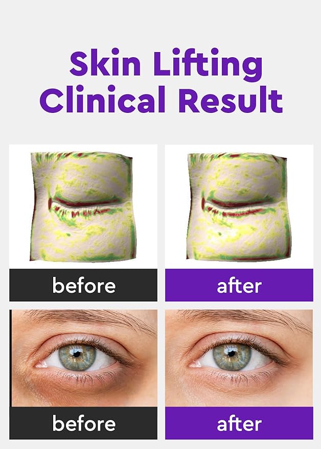 Bewants Instant Eye Bag Remover, Phyto Collagen Roll-On Serum Stick – Refreshing Under Eye Massage with 61% Bamboo Water & 10% Phyto Collagen (2 Pack)