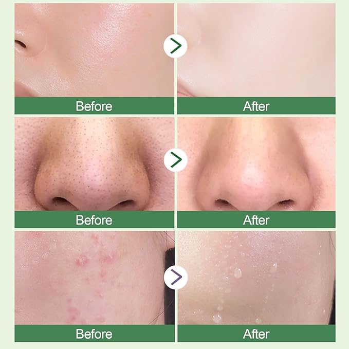 Green Tea Purifying Clay Face Mask, Blackhead Remover With Green Tea Extract, Face Moisturizing,Deep Pore Cleansing for All Skin Types of Men And Women (1 PCS)