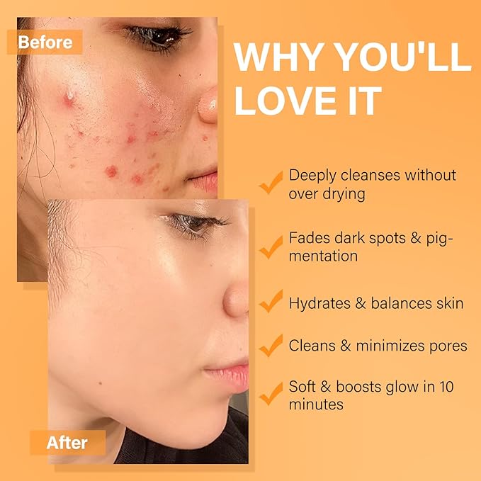 Facial Clay Mask Set - Vitamin C Face Mask with Turmeric, Dead Sea Mud & Salicylic Acid Mask for Pores Cleansing, Blackheads, Dark Spots, Brightening, Face Masks Skincare Gift for Women, 2.82 oz each