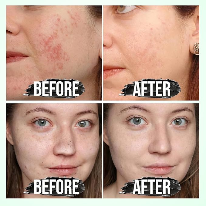 Black Head Remover for Face - Peel Off Charcoal Black Mask, Pore Remover for Nose Deep Cleansing, Pore Remover, Deep Cleansing Blackhead Pores Acne, for All Skin Types