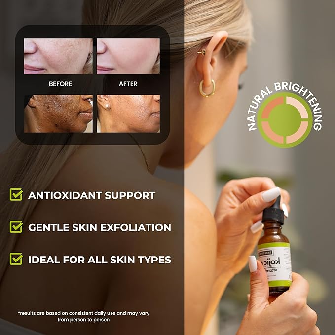 SkinSetGo Dynamic Antioxidant Dark Spot Remover Serum with Kojic Acid, Vitamin C, & Glycolic Acid, For Sun Spots, Age Spots, & Even Skin Tone