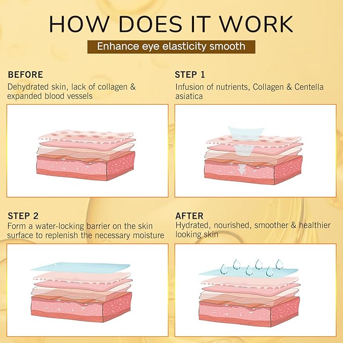 Under Eye Patches for Puffy Eyes and Dark Circles (20 Pairs) Collagen Eye Patches with Hyaluronic Acid & Niacinamide, Eye Mask for Moisturizing, Fine Lines, Dark Circles Under Eye Treatment