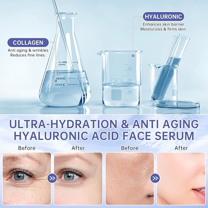 60 Pcs 5% Hyaluronic Acid Serum Ultra-Hydrating Vials, Hyaluronic Acid Tubes, Wake Nature Perfection Hyaluronic Serum, Single-Use Ultra-Hydrating Essence for Face